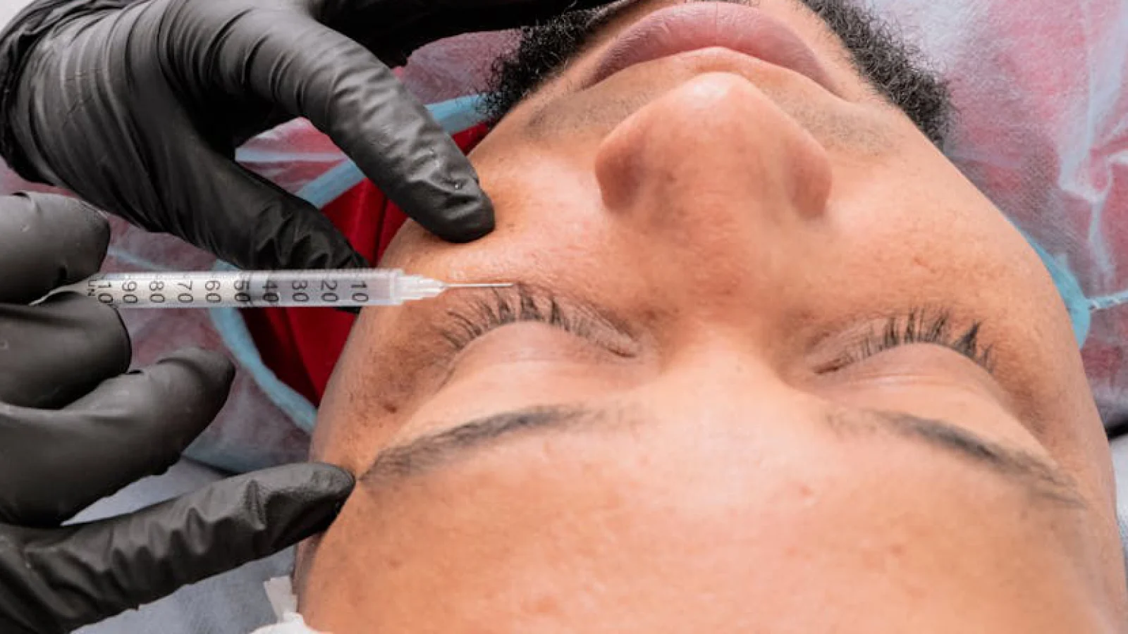 Botox treatment education at Dermis Ottawa