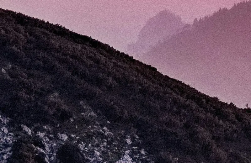 Pigmentation Treatment